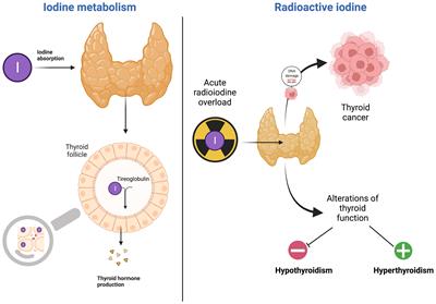 The Iodine Rush: Over- or Under-Iodination Risk in the Prophylactic Use of Iodine for Thyroid Blocking in the Event of a Nuclear Disaster